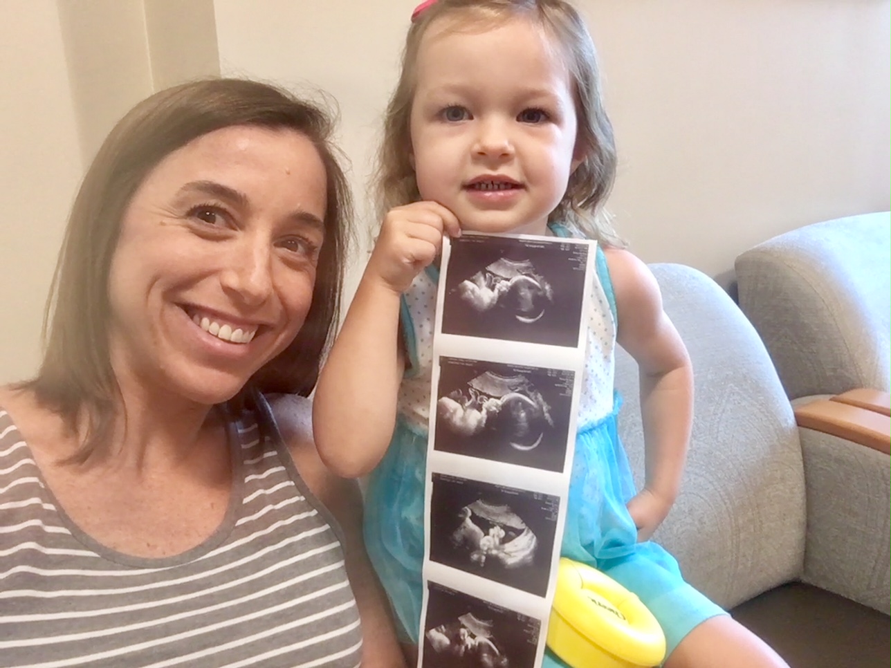 36 week ultrasound