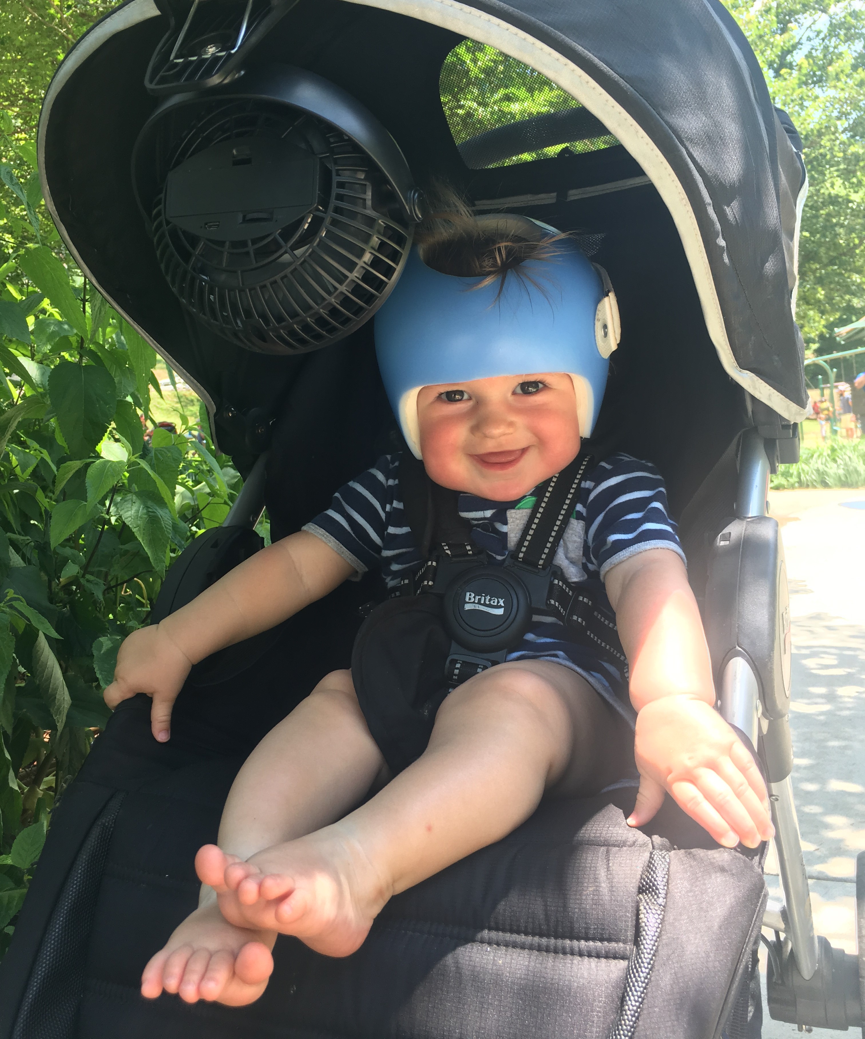 Plagiocephaly and a baby helmet fan